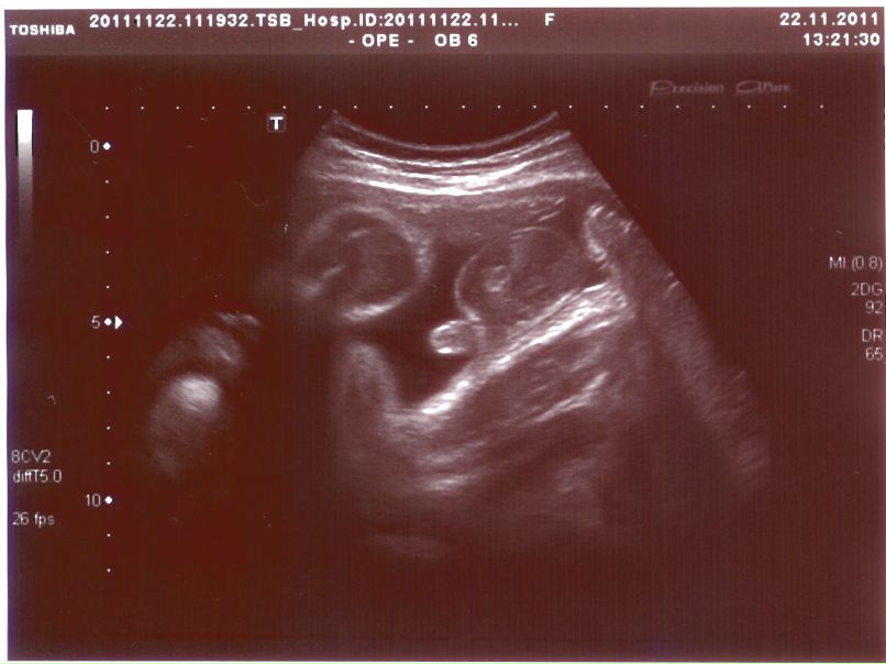 Van Ker фотография #11